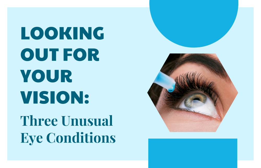 Looking Out For Your Vision: 3 Unusual Eye Conditions